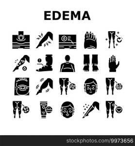 Edema Disease Symptom Collection Icons Set Vector. Venous And Fatty, Lymphatic And Hypoproteinemic, Allergic And Heart Edema Health Problem Glyph Pictograms Black Illustrations. Edema Disease Symptom Collection Icons Set Vector