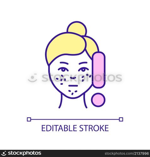 Enlarged pores on face treatment RGB color icon. Skincare routine. Beauty and healthcare. Isolated vector illustration. Simple filled line drawing. Editable stroke. Arial font used. Enlarged pores on face treatment RGB color icon