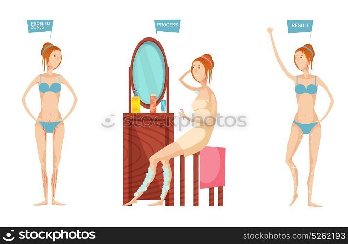 Epilation Before After Illustration. Young woman in front of mirror before and after epilation or depilation isolated on white background flat vector illustration