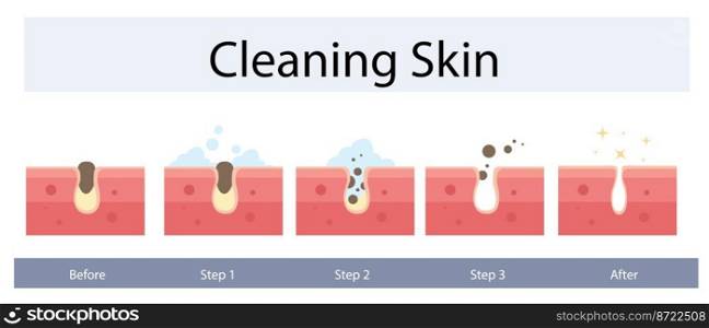 Facial skin care, pore cleaning concept. Cleansing stages on clogged face. Skin cleaning steps. Vector illustration.