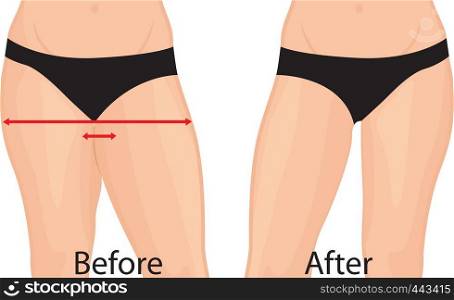 Fat and slim girl's back. Fat thig. Liposuction. Before and after. Woman body correction vector illustration