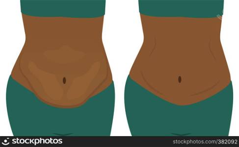 Fat and slim woman stomach. Before and after. vector illusstration