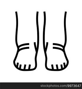 feet edema health disease line icon vector. feet edema health disease sign. isolated contour symbol black illustration. feet edema health disease line icon vector illustration