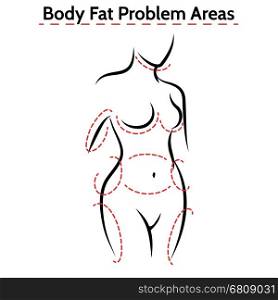 Female body fat problems areas poster. Female body fat problems areas. Vector medical poster with woman silhouette
