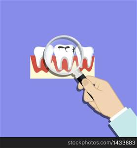 Finding problem teeth, caries, dirty enamel. Magnifying glass in hand. Tooth with caries icon on isolated background. EPS 10 vector. Finding problem teeth, caries, dirty enamel. Magnifying glass in hand. Tooth with caries icon on isolated background. EPS 10 vector.