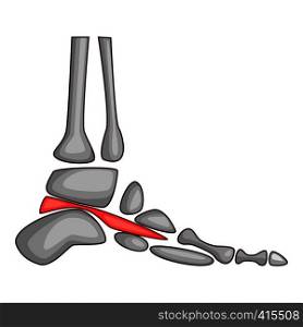 Foot pain icon. Cartoon illustration of foot pain vector icon for web. Foot pain icon, cartoon style
