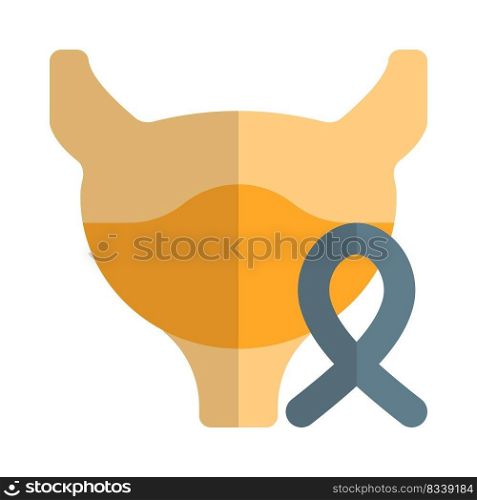 Gallbladder cancer in human body isolated on a white background