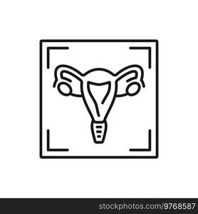 Gynecology ultrasound isolated mri scan outline icon. Vector uterus and ovaries medical examination, obstetrics, computed tomography imaging. Uterus and ovaries medical examination, MRI scan