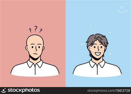 Hair loss and baldness concept. Faces of young completely bald man with frustrated mood and happy smiling hairy person vector illustration. Hair loss and baldness concept.