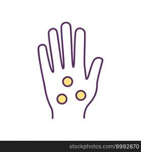 Hand pressure points RGB color icon. Reflexology, acupuncture. Stress and shoulder tension reduction. Migraines, toothaches treatment. Anti-inflammatory effect. Isolated vector illustration. Hand pressure points RGB color icon