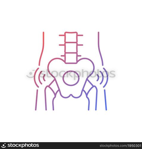 Hips rheumatism gradient linear vector icon. Degenerative joint disease. Intense pain. Cartilage in hip worn away. Thin line color symbol. Modern style pictogram. Vector isolated outline drawing. Hips rheumatism gradient linear vector icon