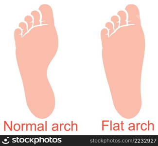 Human anatomy - flat and normal arch vector illustration