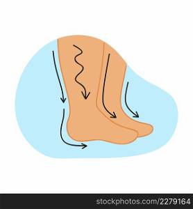 Human feet and leg swelling. Vector illustration on the topic of medicine.