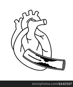 Human heart with Coronary Artery Disease. Outline info graphic. Blocked artery, heart awareness concept. Vector illustration.