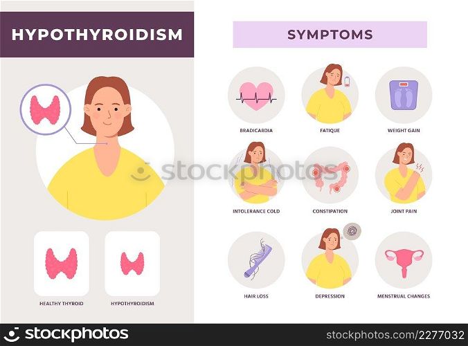 Hypothyroidism disease symptoms infographic with woman character. Underactive thyroid gland. Endocrine system health problem vector poster. Illustration of hyperthyroidism and endocrinology. Hypothyroidism disease symptoms infographic with woman character. Underactive thyroid gland. Endocrine system health problem vector poster
