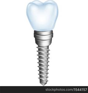 Illustration of dental implant isolated on white background
