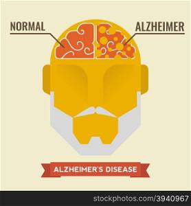 Illustration of human brain with alzheimer disease concept