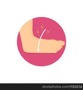 Ilustration of an ankle strain. Bone injury icon. Human healthcare. Ilustration of an ankle strain. Bone injury icon.