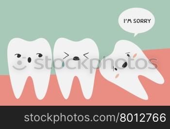 impacted tooth, Vector illustration