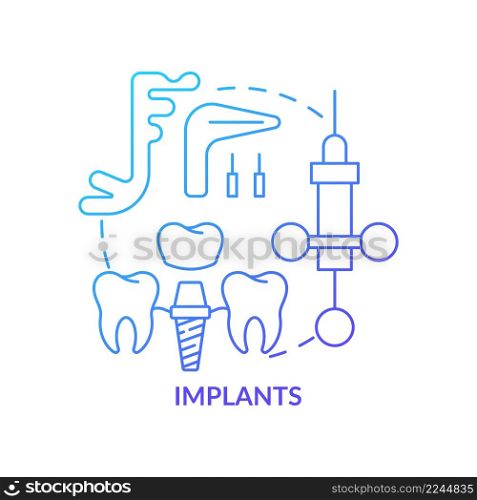 Implants blue gradient concept icon. Cosmetic enhancement procedure abstract idea thin line illustration. Artificial teeth installation. Isolated outline drawing. Myriad Pro-Bold font used. Implants blue gradient concept icon