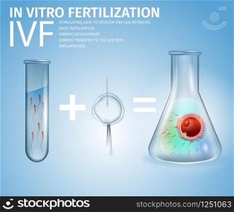 In Vitro Fertilization Formula. Male Sperm in Test Tube Plus Prepared Female Egg Cell Equally Embryo in Beaker on Blue Gradient Background. IVF Stages. Vector Realistic Illustration. Medical Banner. In Vitro Fertilization Formula and Stages Banner