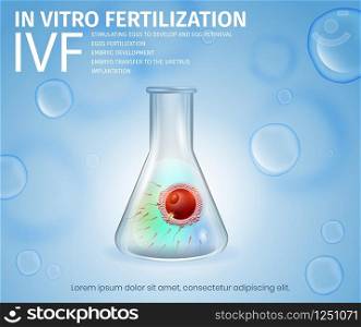In Vitro Fertilization Process. Female Egg and Sperm Union Inside of Glass Beaker. Spermatozoons and Woman Cell in Test Tube. Reproductive System Technology. IVF. Vector Realistic Illustration. Banner. Female Egg and Sperm Union Inside of Glass Beaker.