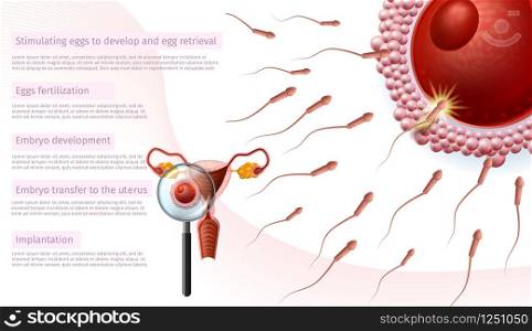 In Vitro Fertilization Stages Medical Banner. Close Up View Through Magnifier on Woman Womb. Stimulating Eggs, Embryo Development, Transfer to Uterus, Implantation. IVF Vector Realistic Illustration.