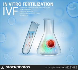 In Vitro Fertilization. Union of Human Egg and Sperm Inside of Beaker. Spermatozoons in Test Tube. Medical Tools for Reproductive Technology. IVF. Vector Realistic Illustration, Banner, Copy Space.