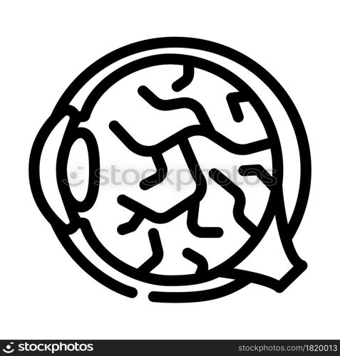 inflammation of eye ophthalmology line icon vector. inflammation of eye ophthalmology sign. isolated contour symbol black illustration. inflammation of eye ophthalmology line icon vector illustration