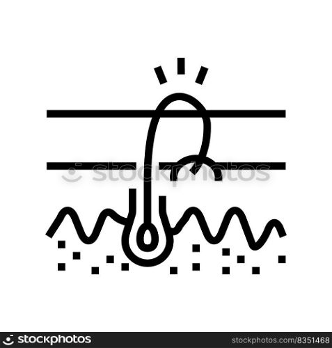ingrowing hair line icon vector. ingrowing hair sign. isolated contour symbol black illustration. ingrowing hair line icon vector illustration