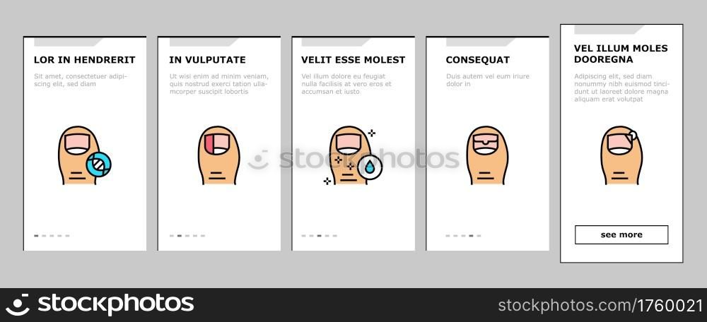 Ingrown Nail Disease Onboarding Mobile App Page Screen Vector. Psoriasis And Onychomycosis, Nail Dark Spots And Surgical Intervention Medical Therapy Illustrations. Ingrown Nail Disease Onboarding Icons Set Vector