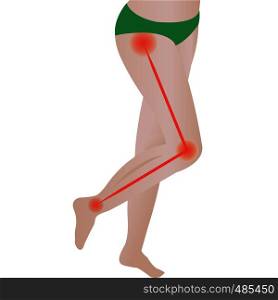 Joint pain. Sciatic Nerve. sciatic back pain. vector illustration