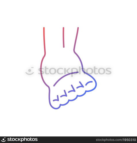 Joint sprain gradient linear vector icon. Ankle ligaments tearing. Sports injury. Overstretched joint. Muscle damage. Thin line color symbol. Modern style pictogram. Vector isolated outline drawing. Joint sprain gradient linear vector icon