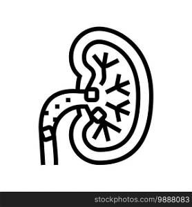 kidney stones line icon vector. kidney stones sign. isolated contour symbol black illustration. kidney stones line icon vector illustration