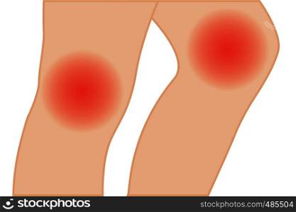 Knee pain because vector illustration