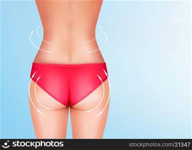 Lines, showing surgery on female body. Vector.