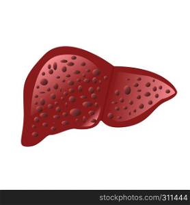 Liver affected by cirrhosis vector illustration