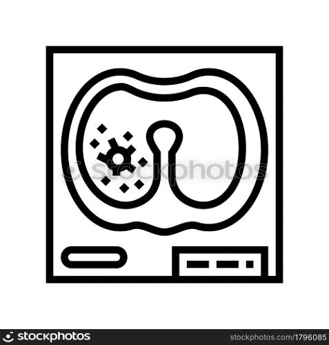 lung mucormycosis line icon vector. lung mucormycosis sign. isolated contour symbol black illustration. lung mucormycosis line icon vector illustration