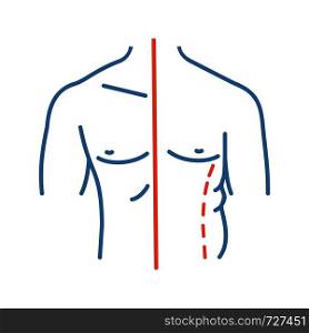 Male coolsculpting color icon. Flanks correction. Male liposuction and body contouring before and after. Plastic surgery. Isolated vector illustration. Male coolsculpting color icon