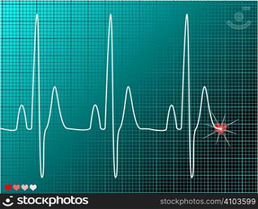 Medical abstract ecg monitor overlayed on an technical grid
