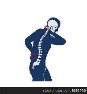 Medical Concept Illustration of Musculotendinous Strain Back Ache or Lumbar Pain.