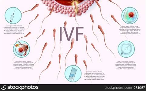 Microscopic Research View of In Vitro Fertilization Process Close Up. Laboratory Equipment and Stages of IVF Icons. Vector Realistic Illustration. Human Reproductive Medicine Banner with Copy Space.. Human Reproductive Medicine Banner with Copy Space
