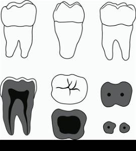 molar tooth with different angles and in the context. molar tooth