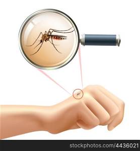 Mosquito on hand. Realistic composition with human hand and mosquito in magnifying glass zoom vector illustration