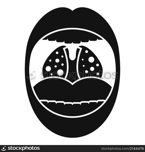 Mouth tonsillitis icon simple vector. Tonsil anatomy. Bacterial ent. Mouth tonsillitis icon simple vector. Tonsil anatomy