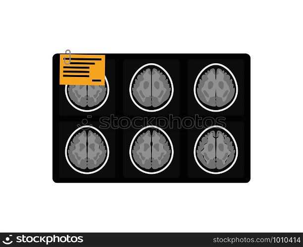 MRI x-ray brain picture in flat style, vector. MRI x-ray brain picture in flat style