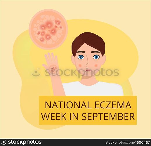 National eczena week in September. Cartoon vector poster with yellow fluid background. Sad cute man. Disease of the skin and dermatological problems.. National eczena week in September. Cartoon vector poster with yellow fluid background.