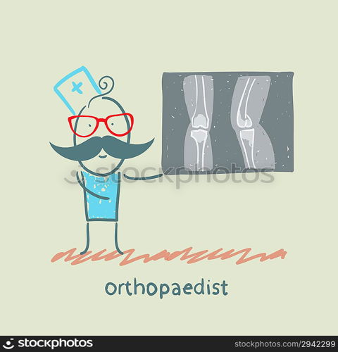 orthopaedist shows an X-ray