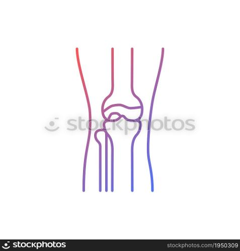 Osteoarthritis gradient linear vector icon. Cartilage inflammation. Degenerative joint disease. Pain in knee. Thin line color symbol. Modern style pictogram. Vector isolated outline drawing. Osteoarthritis gradient linear vector icon