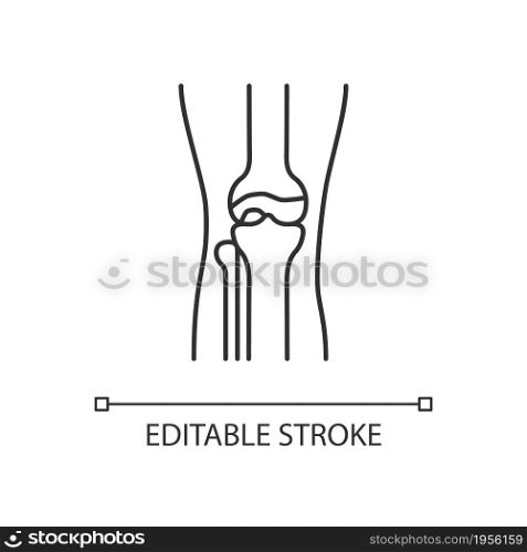 Osteoarthritis linear icon. Cartilage inflammation. Degenerative joint disease. Pain in knee. Thin line customizable illustration. Contour symbol. Vector isolated outline drawing. Editable stroke. Osteoarthritis linear icon